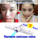 Magic Blue Light Facial Machine for Acne, Wrinkles, and Spider Veins Removal - All-Gadgetry